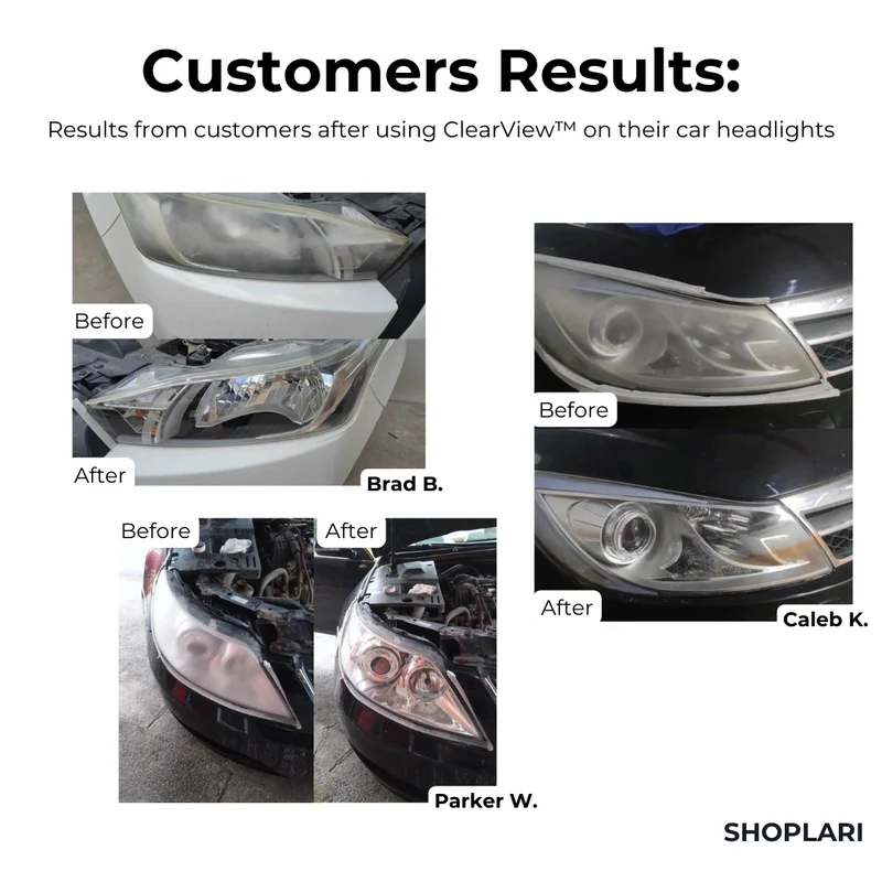 ClearView™ Scheinwerfer-Reparaturflüssigkeit I Letzter Tag 1+1 GRATIS🔥