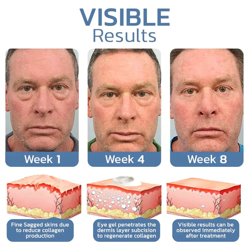 EyeRefresh™ Peptid Straffendes Augengel