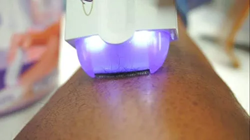 LaserSchlösser™ Stärkt die Haarwurzeln
